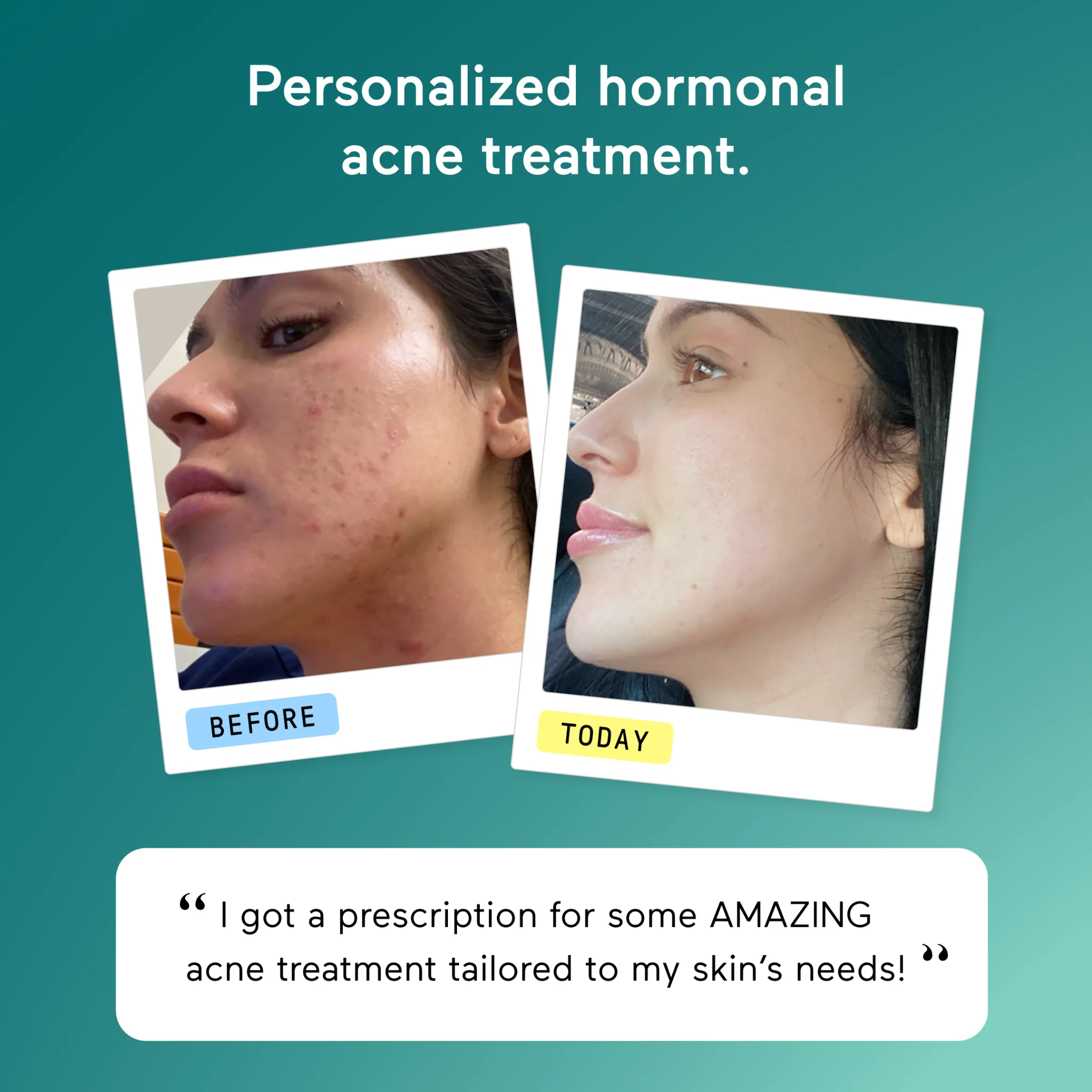 Facebook and Instagram ad by Apostrophe on customized treatment after a virtual derm visit